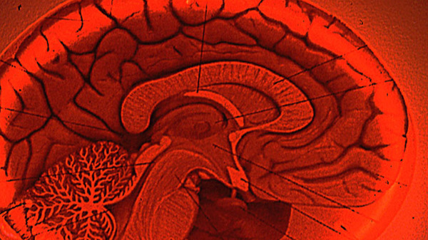 Med thumb brain